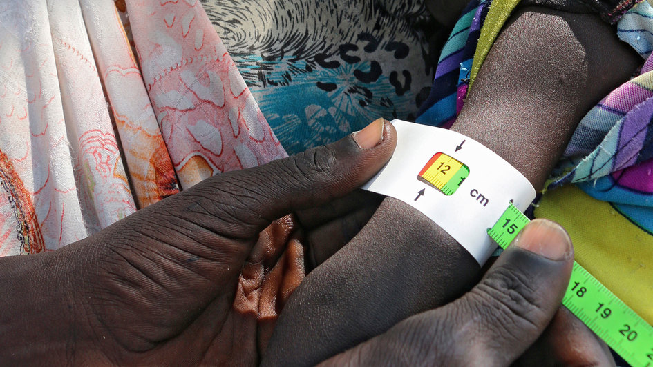 Bei einem Baby im Südsudan wird der Armumfang gemessen